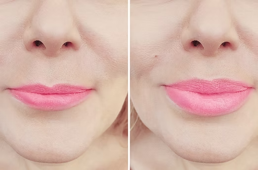 No Instant Comparison