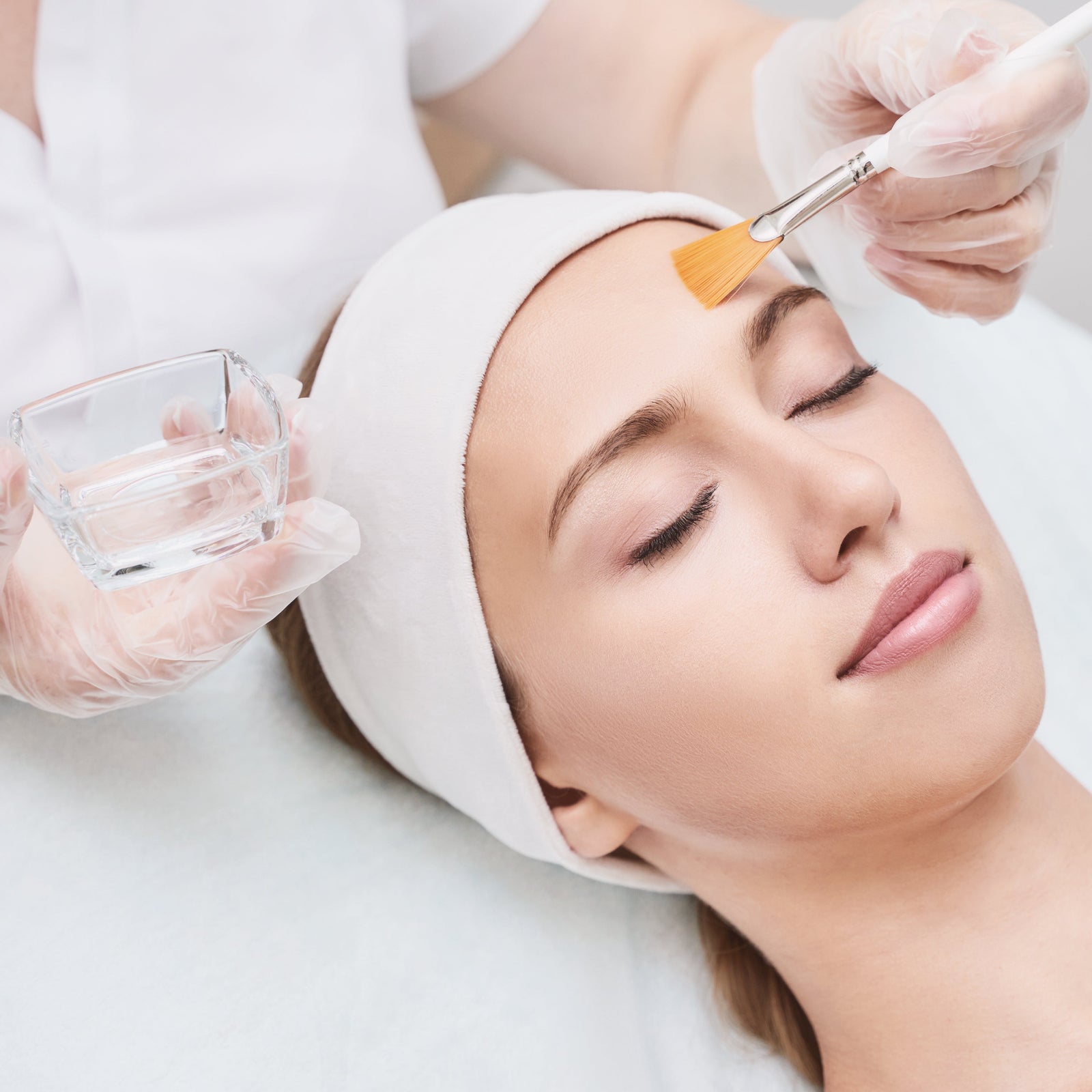 Chemical Peels