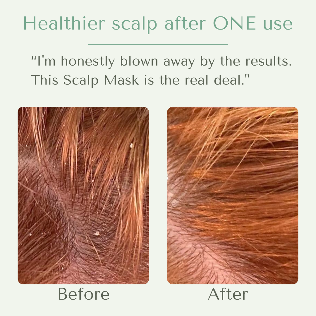 Yobee Restorative Scalp Mask™