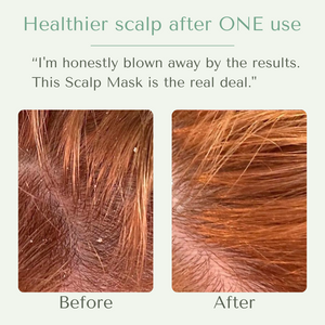 Yobee Restorative Scalp Mask™
