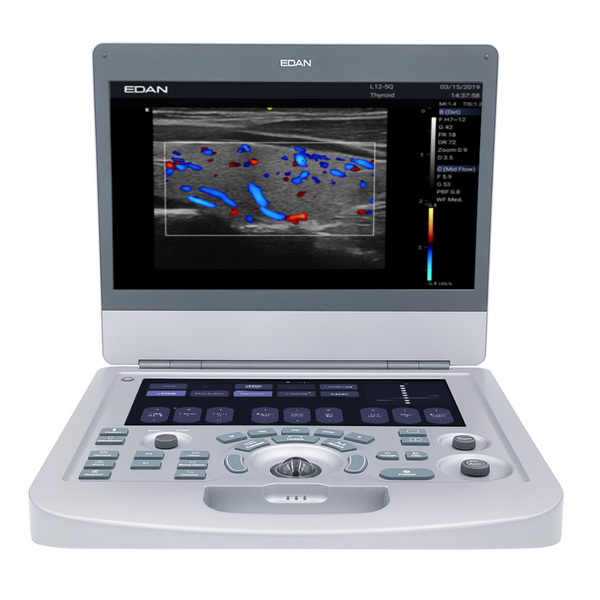 Edan Acclarix AX2 Compact Color Doppler Ultrasound System