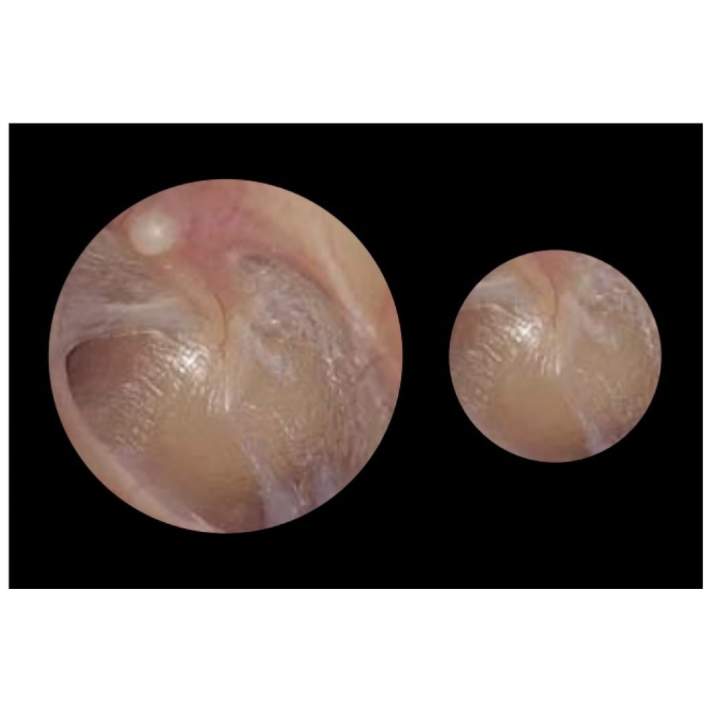 Adstation™ 5610-3/5680-3 Basic 3.5V Diagnostix Wall System PMV