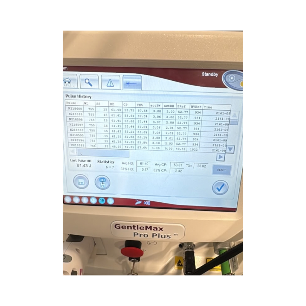 Candela GentleMax Pro Plus touchscreen displaying pulse history log and treatment data table