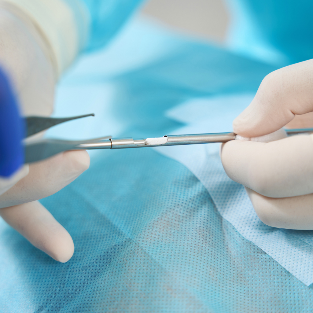 Cannula / Trocar System for Pellet Insertion Reusable (4.5mm) shown during a hormone replacement pellet insertion procedure 