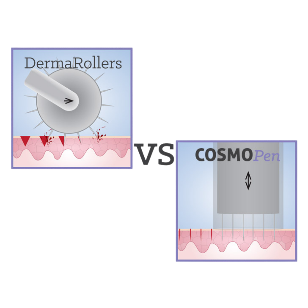 CosmoPen Microneedling System