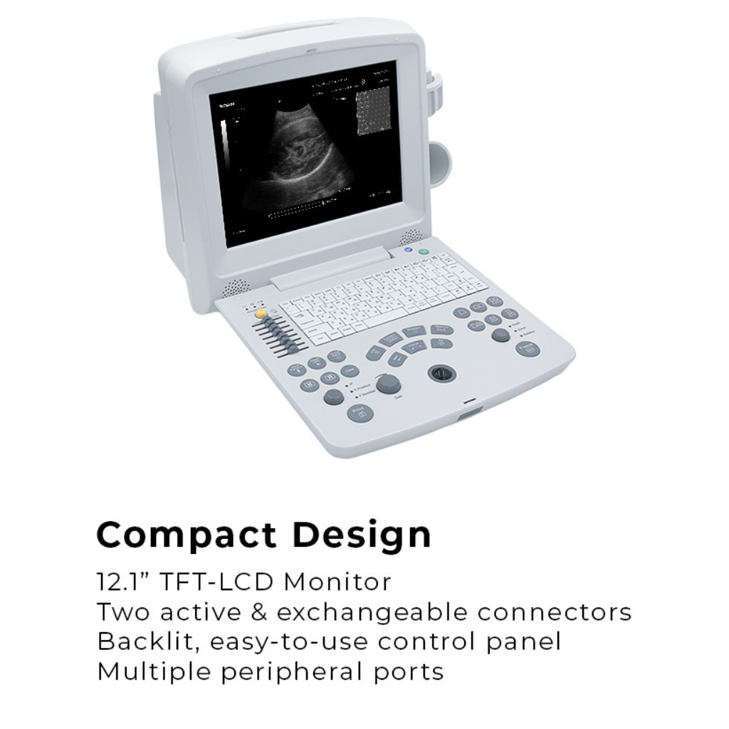 Edan DUS60 Diagnostic Ultrasound System