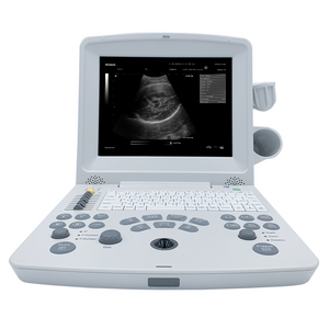 Edan DUS60 Diagnostic Ultrasound System