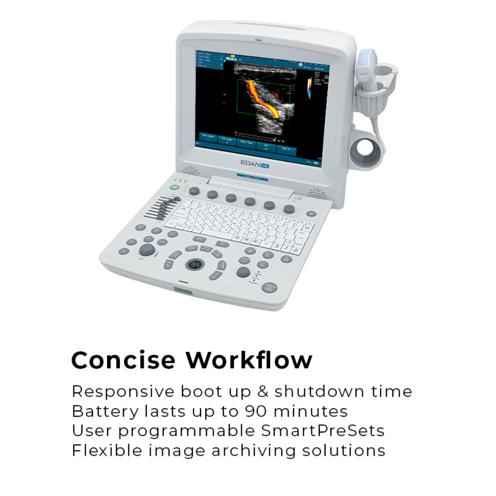 Edan U50 Diagnostic Ultrasound System