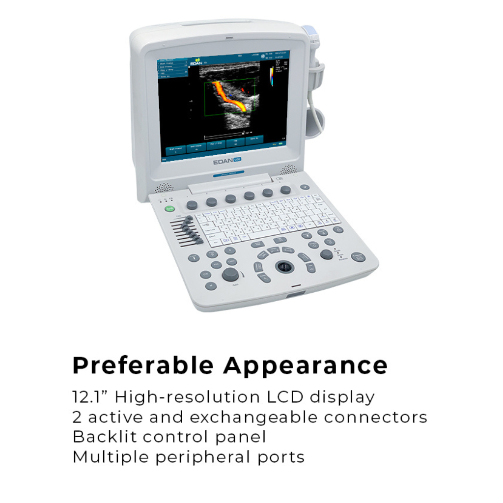 Edan U50 Diagnostic Ultrasound System