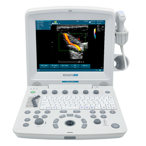 Edan U50 Diagnostic Ultrasound System