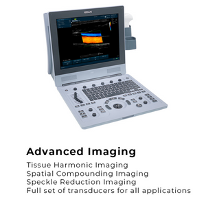 Edan U60 Diagnostic Ultrasound System