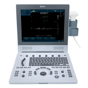 Edan U60 Diagnostic Ultrasound System