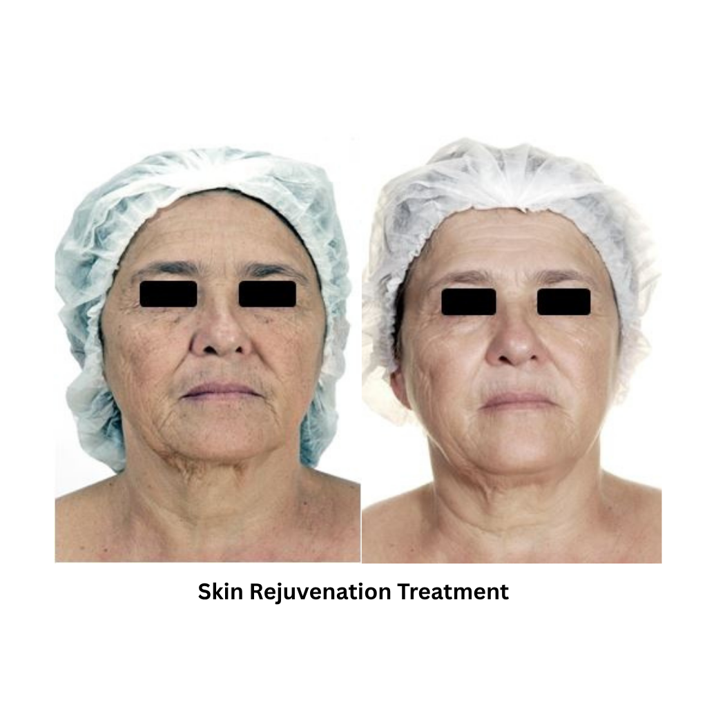 Extra 818 Hair Removal & Facial Treatment System