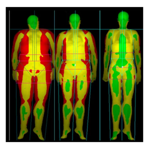 GE Lunar Prodigy Advance DXA Scanner Body Composition