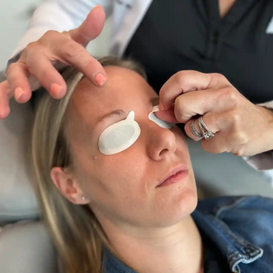 IPL-AID™ Disposable patient eye protection