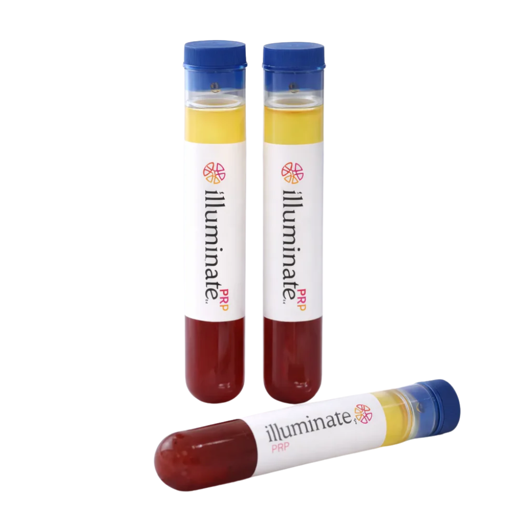 Three 'illuminate' PRP tubes with blue caps and blood and plasma liquid on a white background