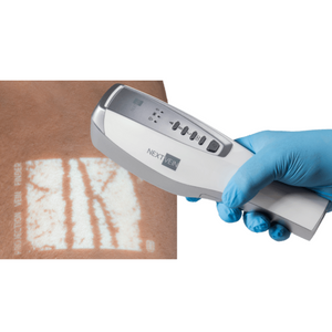 Vein Scanner Scanning Skin Showing Veins