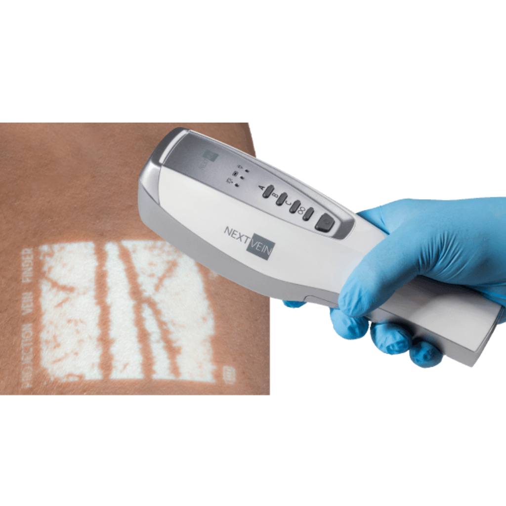 NextVein’s Vein Finder System (V800NV) Scanning a Patients Skin