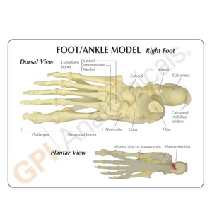 GPI Anatomicals Foot/Ankle – Plantar Fasciitis – Model #1980