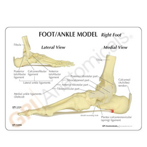 GPI Anatomicals Foot/Ankle – Plantar Fasciitis – Model #1980