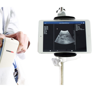 Healcerion SONON Convex Handheld Ultrasound (300C)