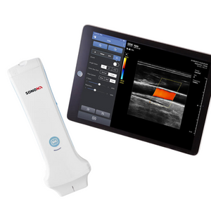 SONON Linear Ultrasound (300L)