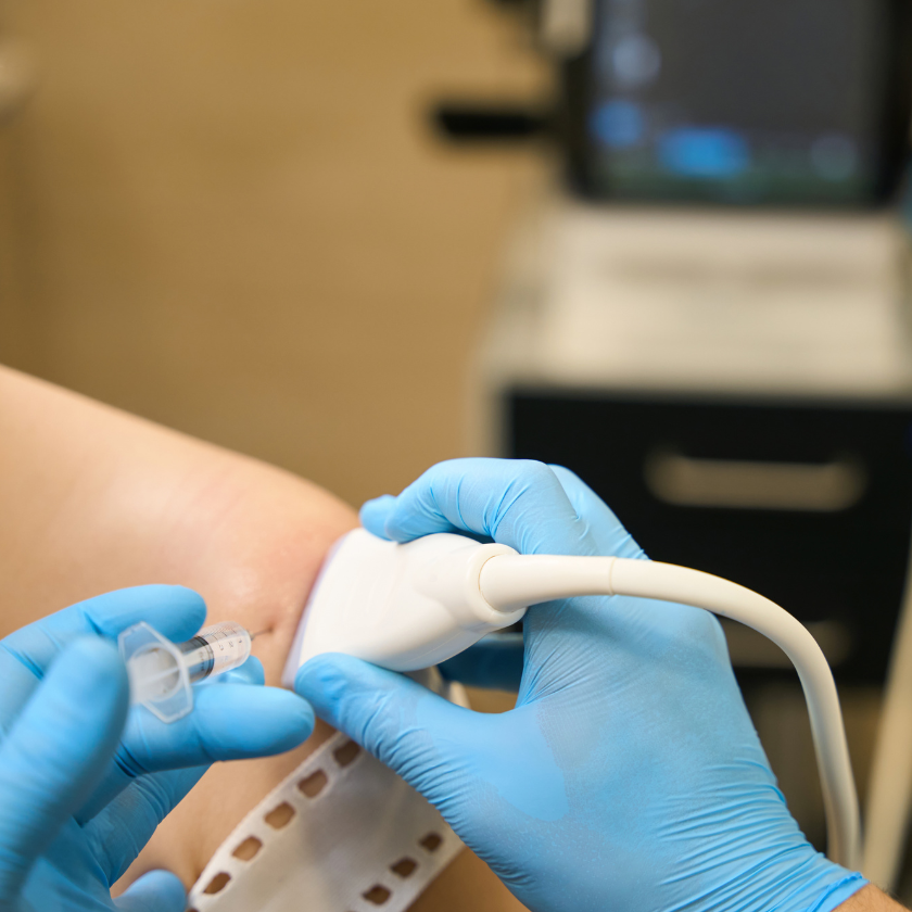 Ultrasound and injection in knee