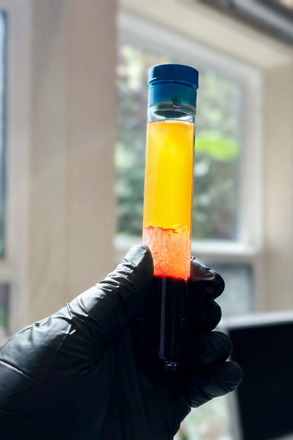 Cleaner PRP with reliable platelet separation